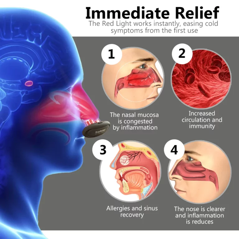 Oveallgo™ ProX RespiRelief Red Light Nasal Therapy Instrument