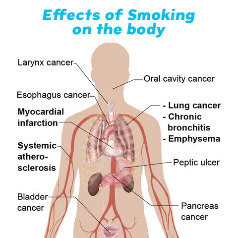 Oveallgo™ PuffStop Quit Smoking Inhaler
