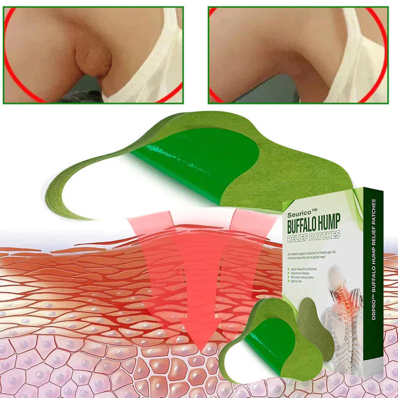 Seurico™ Lymphatic Drainage Patches
