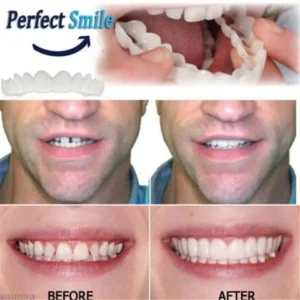 Seurico™ Smile OrthoCraft