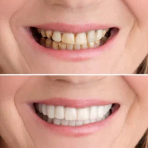 Seurico™ Smile OrthoCraft