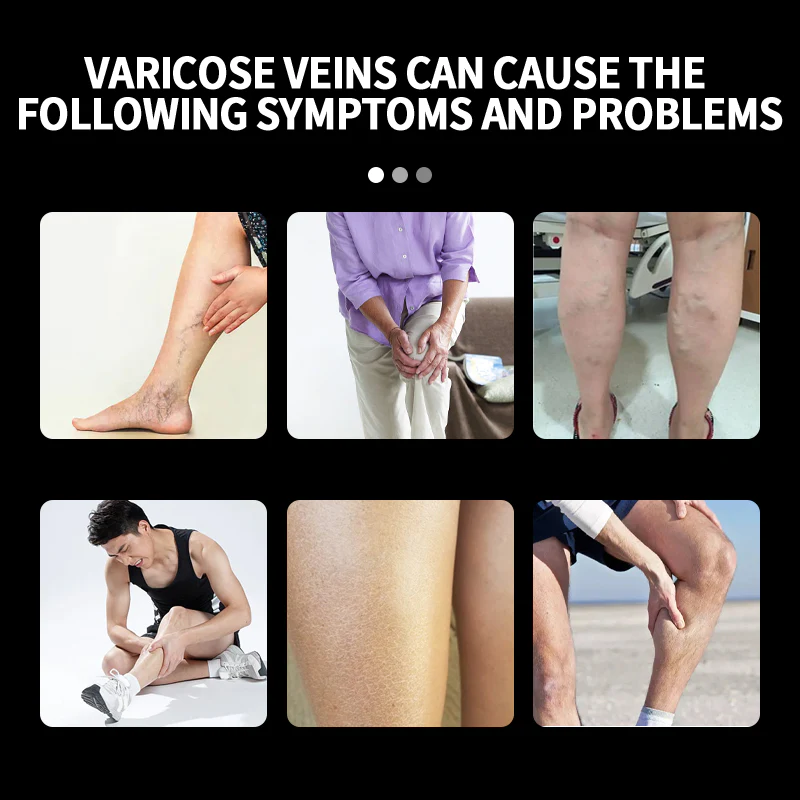 Seurico™ Vein Varicose Relief Spray