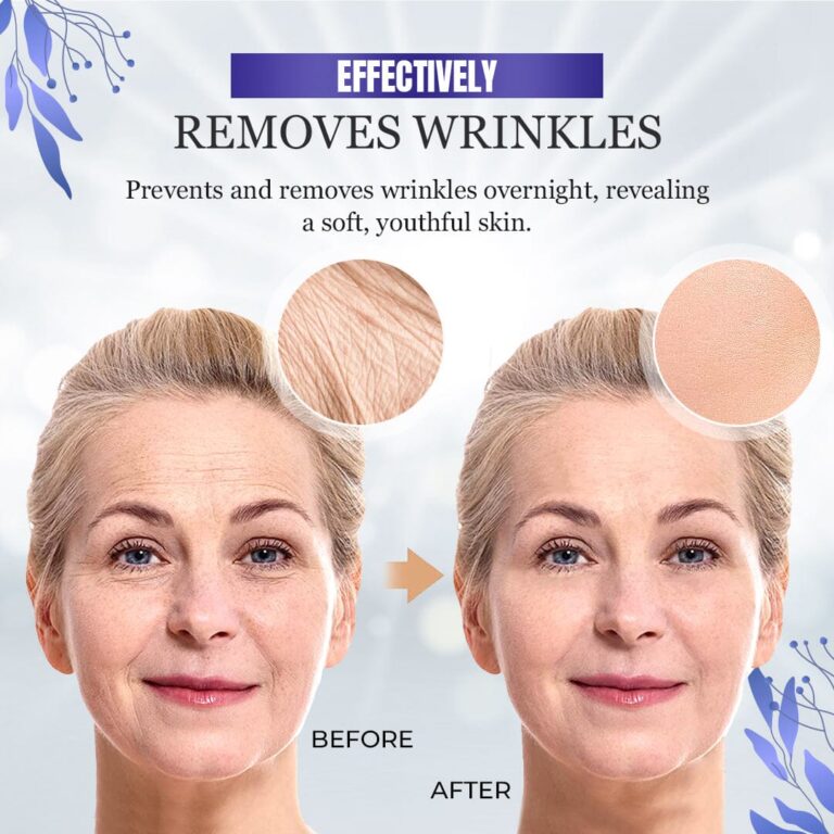 Seurico™ Wrinkle-Reducing Set