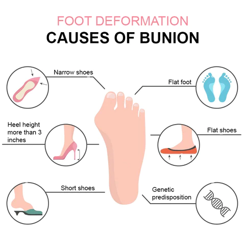 StrongJoints Bunion Relief Patch