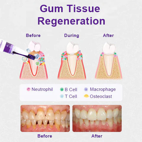 UNPREE™ Gum Treatment Essence