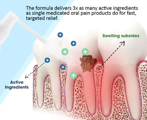 UNPREE™ Tooth Relief Spray