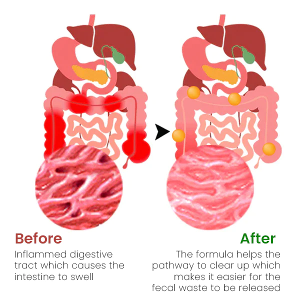 Vflux™ Constipation Relief Capsule