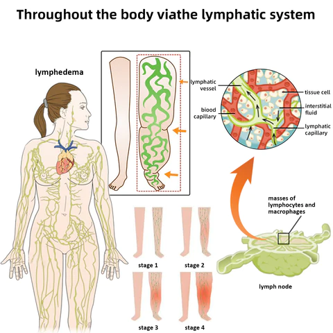 Lukmlca™ 𝐁𝐞𝐞 𝐕𝐞𝐧𝐨𝐦 𝐋𝐲𝐦𝐩𝐡𝐚𝐭𝐢𝐜 𝐃𝐫𝐚𝐢𝐧𝐚𝐠𝐞 & 𝐒𝐥𝐢𝐦𝐦𝐢𝐧𝐠 𝐅𝐨𝐨𝐭 𝐒𝐨𝐚𝐤 𝐁𝐞𝐚𝐝𝐬