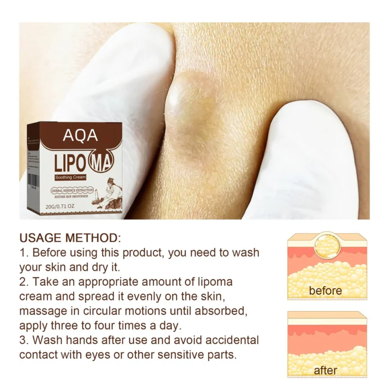 AQA™ Lipoma Soothing Cream