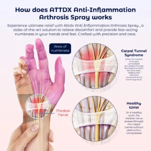 ATTDX Anti-Inflammation Arthrosis Spray