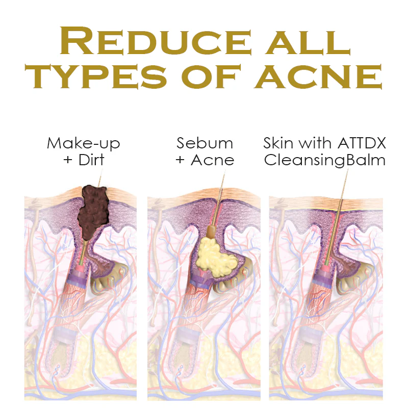 ATTDX SkinPurity Acne Youthful Serum