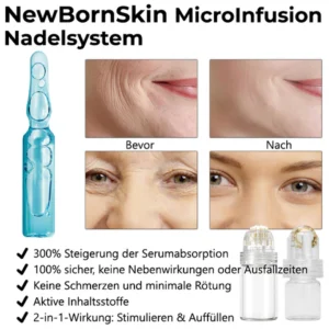 ATTDX SkinRevive MicroInfusion Needle System