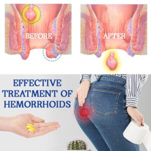 Biancat™ AnalEase Hemorrhoid Repair Herbal Capsules