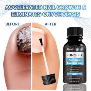 Biancat™ FungiFix Nail Fungus Treatment Care Fluid