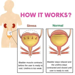 Bladder Control Patch