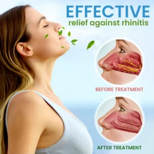 BreathLux™ Rhinitis Relief Cream