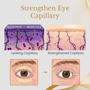 Ceoerty™ AgeErase Collagen Eye Cream