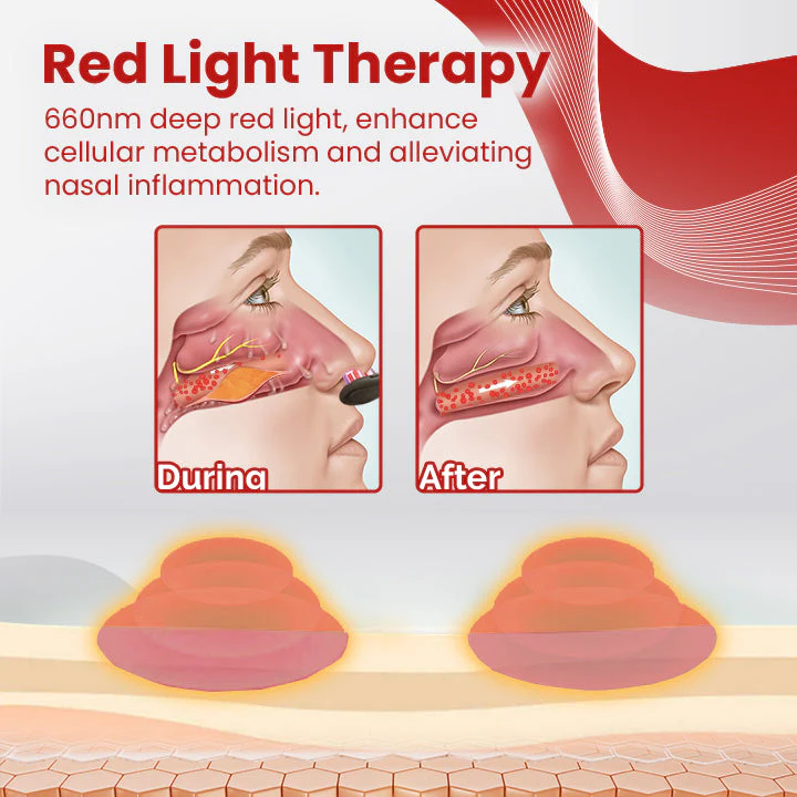 Ceoerty™ RespiClear Red Light Nasal Therapy Device