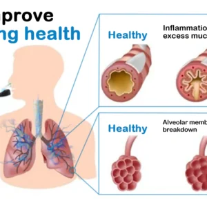 DOCTIA™ Magnetic Deep Lung Cleansing Nasal Dilator