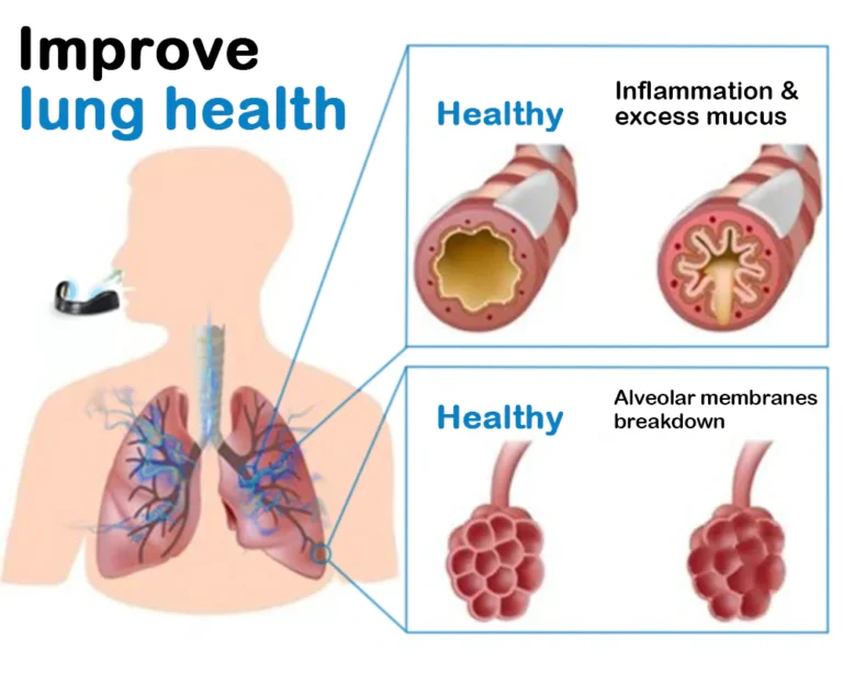 DOCTIA™ Magnetic Deep Lung Cleansing Nasal Dilator