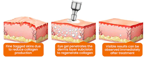 EYEPLUS™ Vitamin C Depuffing Eye Serum