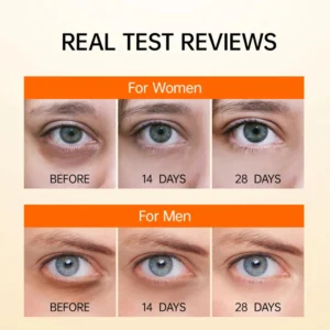 EYEPLUS™ Vitamin C Depuffing Eye Serum