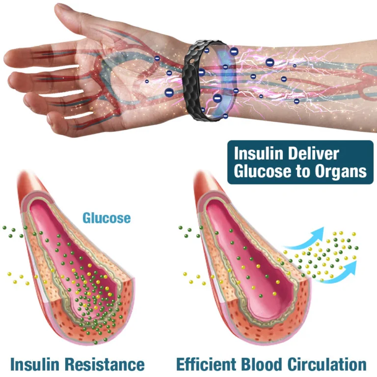 GFOUK™ SucrosePro Ionic Balance Wristband