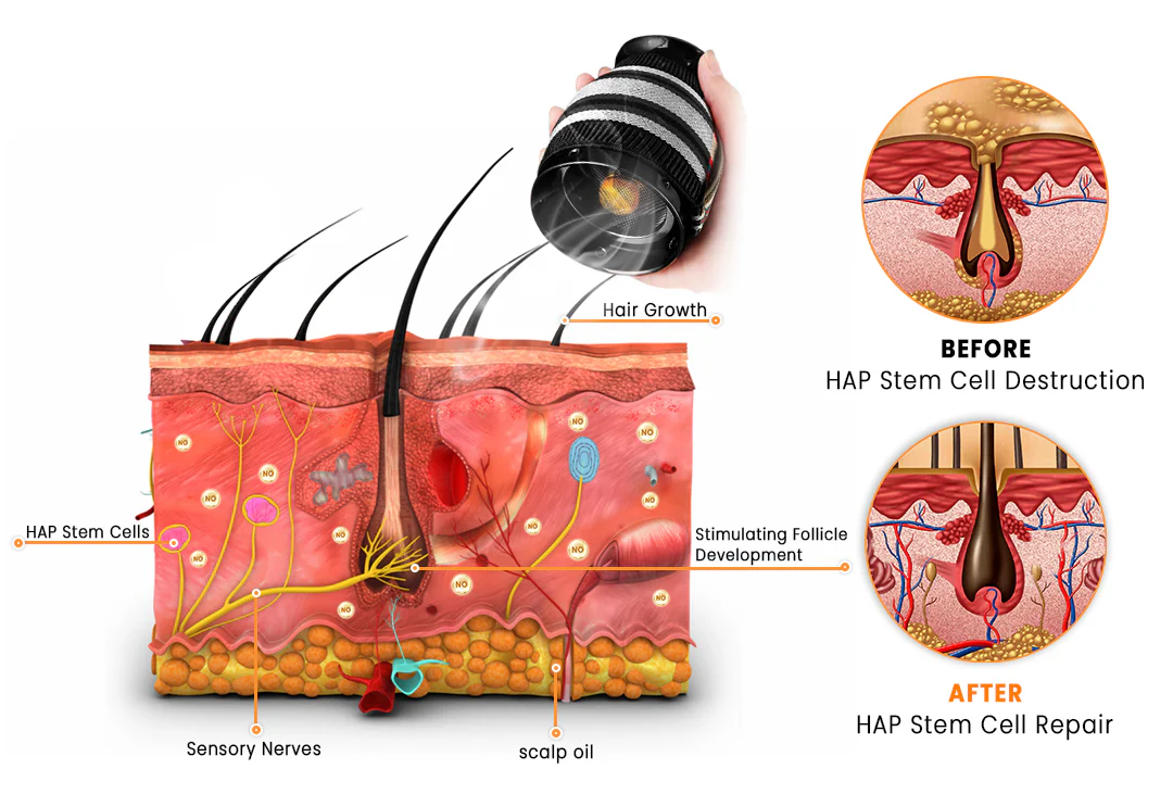 LUHAKA™ Moxibustion Hair Regrowth Device
