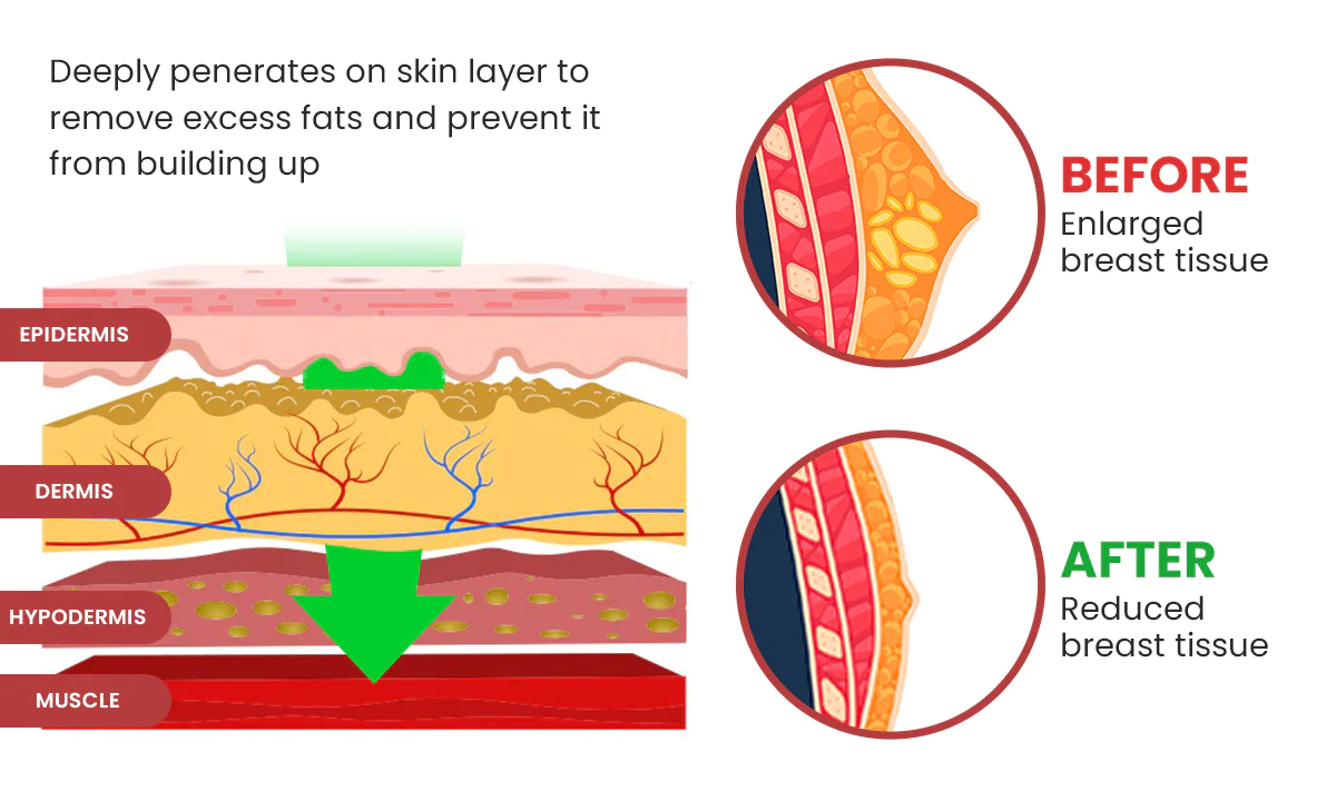 Luhaka™ Gynecomastia Cellulite Melting Patch