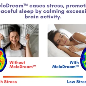 MeloDream™ Melatonin Sleep Patches