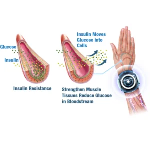 Nurbini™ GlycoWave Electric Pulse Device