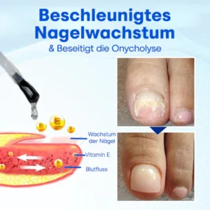 Nurbini™ OnyxoGuard Serum für Nagelwachstum und -reparatur