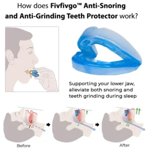 Oveallgo™ Anti-Snoring and Anti-Grinding Teeth Protector