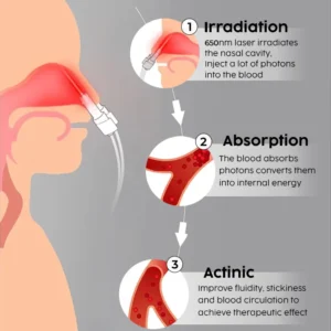 Oveallgo™ AuraGlow Nasal LED Therapy Device