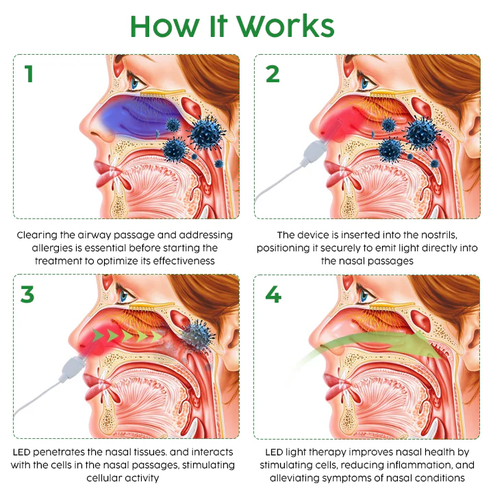 Oveallgo™ AuraGlow Nasal LED Therapy Device