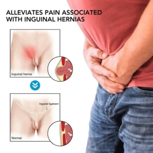 Oveallgo™ Inguinal Hernia Treatment Cream