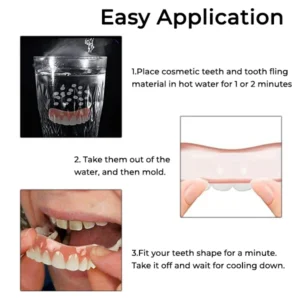 Oveallgo™ Soft Denture Reline Kit