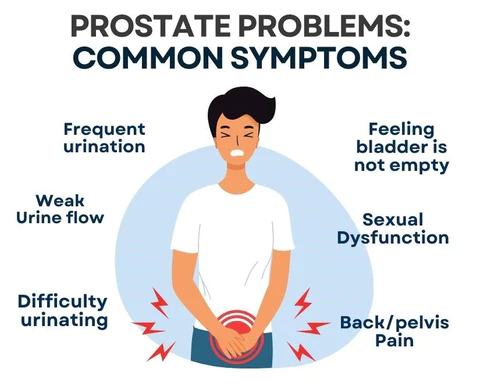 Prostate Therapy Capsules - Supporting Healthy Prostate Function
