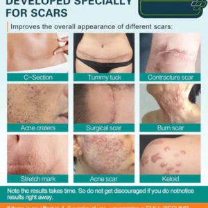 SCARGone™ Advanced Scar Spray