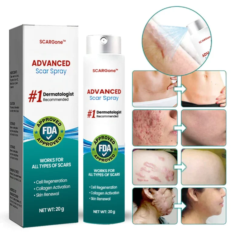 SCARGone™ Advanced Scar Spray