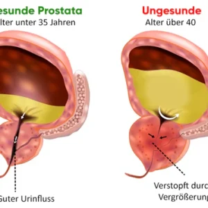 VitaCare™ Prostata-Behandlung Spray