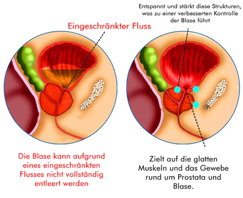 VitaCare™ Prostata-Behandlung Spray