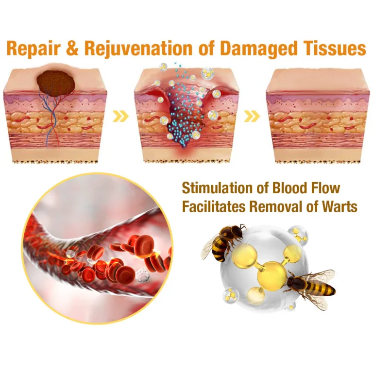 flysmus™ TagRecede Bee Venom Treatment Spray