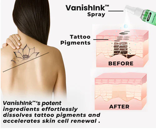 VanishInk™ Tattoo Removal Treatment Set