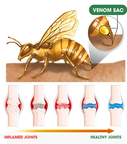 BBOJI™ Bee Venom Joint Therapy Pain Relief Gel