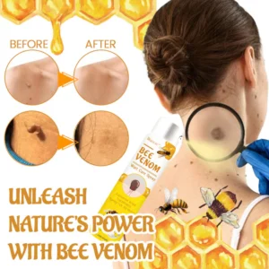 Biancat™ Bee Venom Wart Care Spray