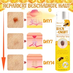 Biancat™ Bienenstich-Warzenpflegespray