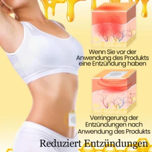 Ceoerty™ LymphTox Bienengift Entgiftungs- und Schlankheitspflaster