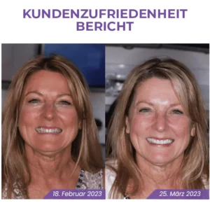 Fivfivgo™ Rein pflanzliches Zahnweiß-Mousse