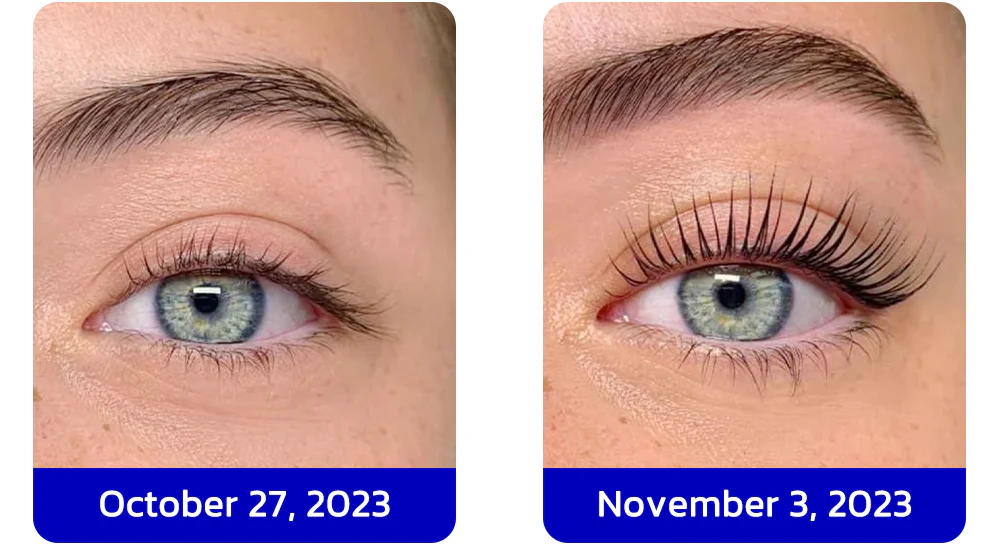 Furzero™ InfiniteGrowth 2in1 Eyelash Enhancing Serum and Mascara